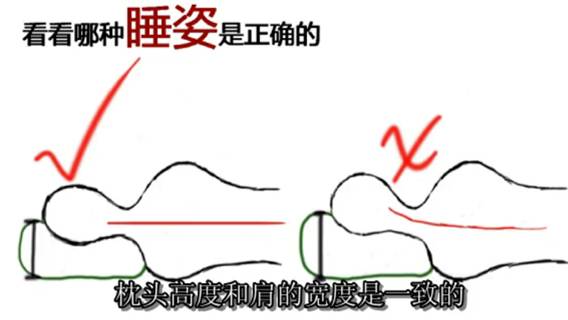 颈椎有毛病怎么治疗和调理,颈椎病的最好治疗方法小妙招