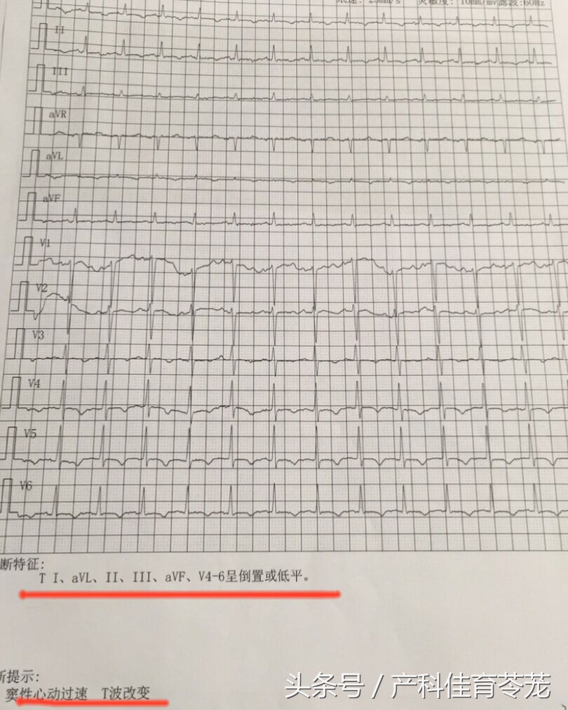 怀孕初期感冒咳嗽喉咙疼怎么办,怀孕感冒咳嗽对胎儿有什么影响