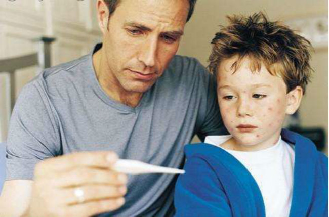 每个小朋友都会出水痘吗,孩子出水痘应该注意哪些问题