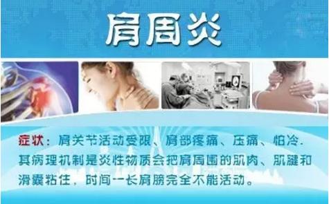 肩周炎按摩热敷护肩,生姜敷肩可以改善肩周炎吗