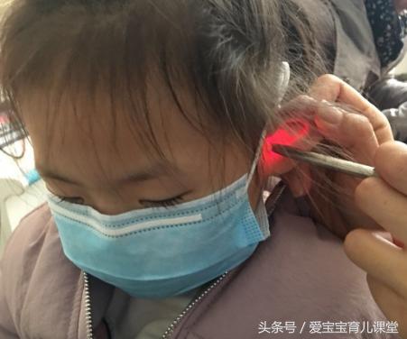 小孩子不容易得中耳炎,妈妈得了中耳炎