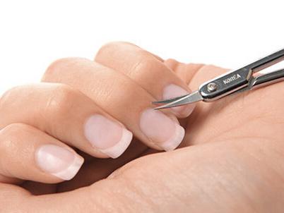 倒刺如何去除扎进手里,倒刺去除