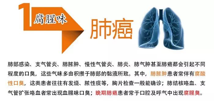 出现口臭不仅仅是口腔问题，居然还有可能是绝症！