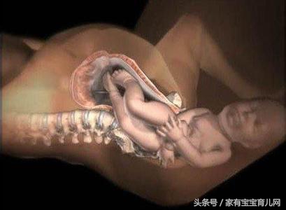 分娩一般先见红还是先宫缩,破水和见红哪个先比较好生