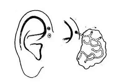 宝宝眼睑发炎里面有脓点,宝宝眼皮经常肿最后化脓