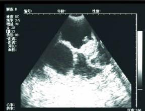备孕2年检查遍了还怀不上咋办,备孕二年终于怀孕了