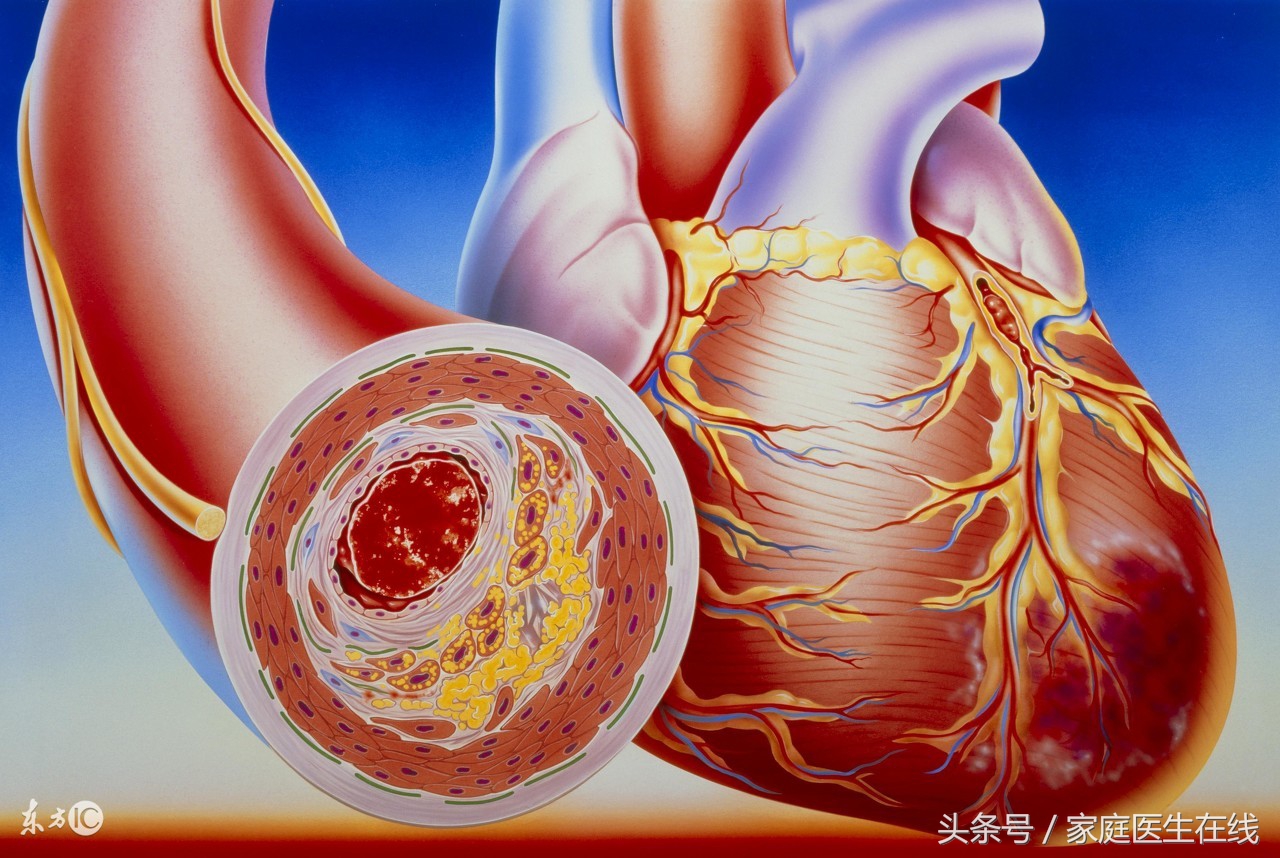 确诊糖尿病可以不治疗吗,得了糖尿病不治疗会有什么后果