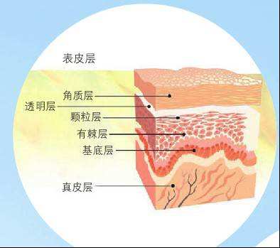 倒刺如何去除扎进手里,倒刺去除