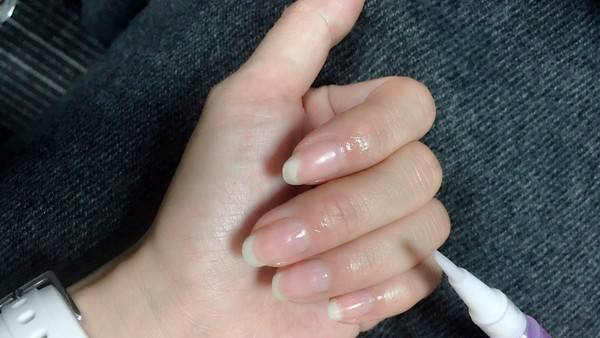 倒刺如何去除扎进手里,倒刺去除