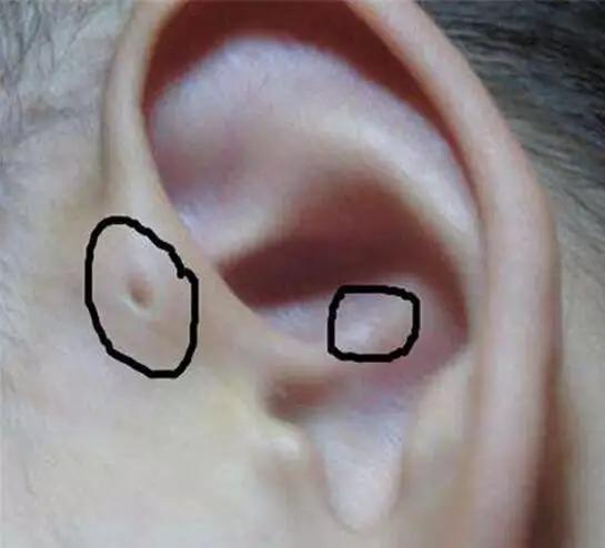 宝宝眼睑发炎里面有脓点,宝宝眼皮经常肿最后化脓