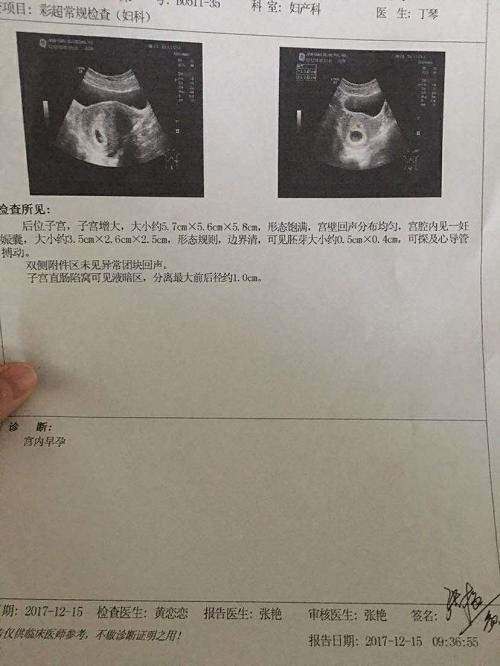 顽固多囊终升级，细数我的好孕经验！接棒吧！