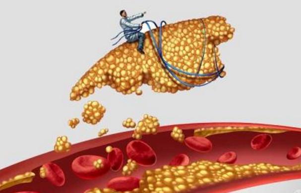 高血脂症怎么从根源上治疗,咋治疗高血脂症状