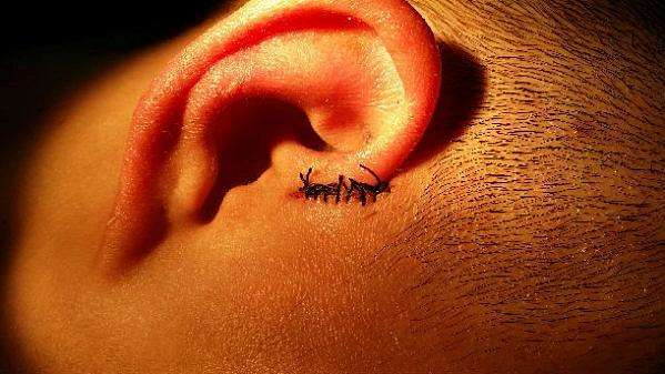 宝宝眼睑发炎里面有脓点,宝宝眼皮经常肿最后化脓