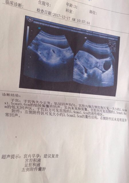 备孕2年检查遍了还怀不上咋办,备孕二年终于怀孕了