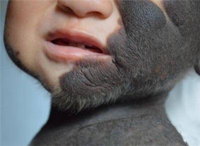 孕期吃了长毛的食物怎么办,怀孕期间吃各种东西生下来的宝宝