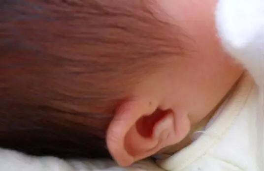 宝宝眼睑发炎里面有脓点,宝宝眼皮经常肿最后化脓