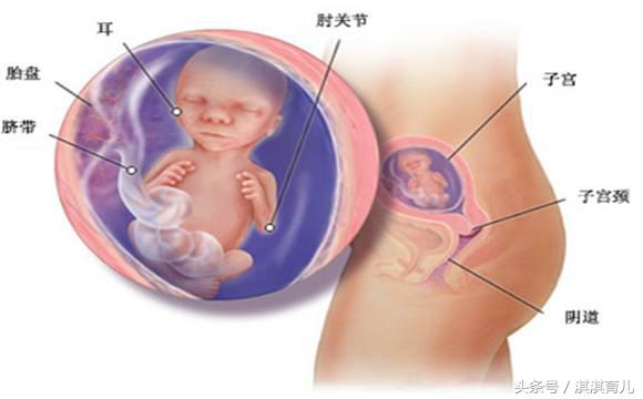 羊水浑浊一般是什么情况引起的,羊水浑浊有危险么