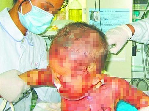 一岁宝宝起毒疙瘩正常吗,小孩身上出毒疙瘩怎么办