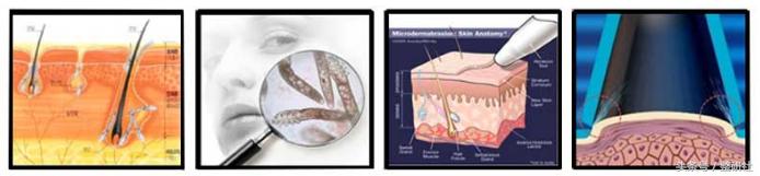 温良轻*女熟**修炼计——毛孔细致