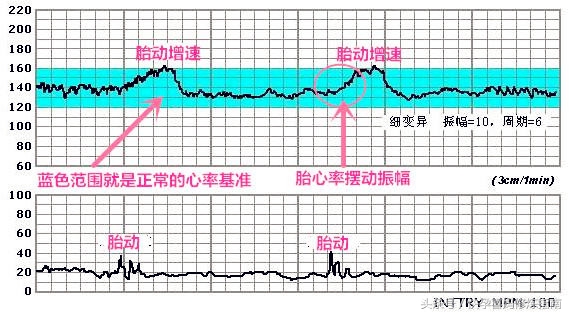 从韩寒、高晓松家闺女开扒：怎样生个萌萌的美闺女！