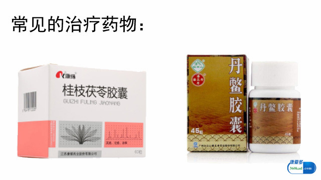 慢性盆腔炎的症状有哪些？常用的治疗药物有哪些？