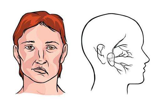 面部失去知觉是什么原因引起的,面部识别失灵是什么原因