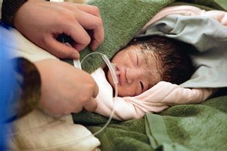 产妇生产过程中会有什么突发状况,急产对产妇和新生儿有什么影响