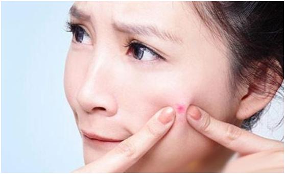 换季长痘,换季时脸上总长痘怎么办