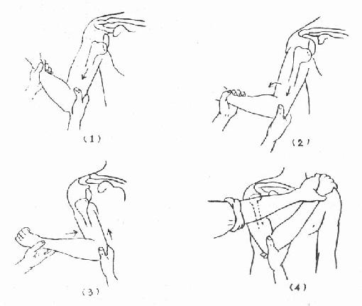 小儿桡骨半脱位的症状,小儿桡骨半脱位临床表现
