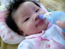 怎样快速缓解孩子鼻塞,如何消除小朋友的鼻塞