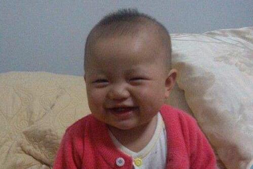 当心！3种药物4种习惯易致胎儿“兔唇”