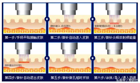 温良轻*女熟**修炼计——毛孔细致
