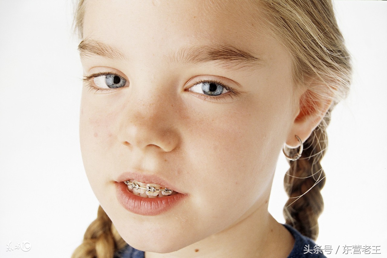 儿童矫正牙齿黄金时间,儿童矫正的黄金期