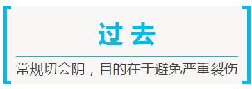 生孩子,你需要做会阴侧切么?