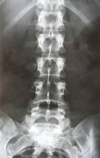 运动康复师教看核磁,运动康复脊骨梳理训练