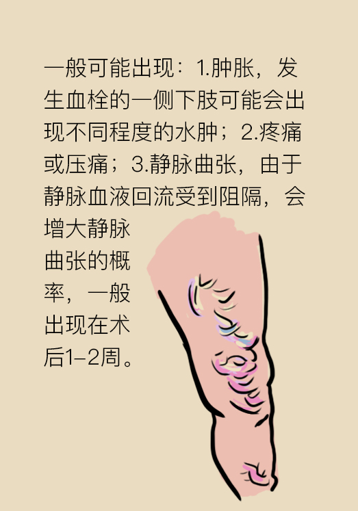 下肢血栓穿弹力袜的注意事项,下肢血栓穿的医用弹力袜怎么选