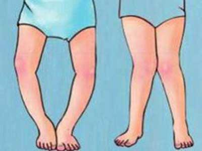 怎么查小月龄宝宝缺不缺维生素d,宝宝冬季怎么补充维生素