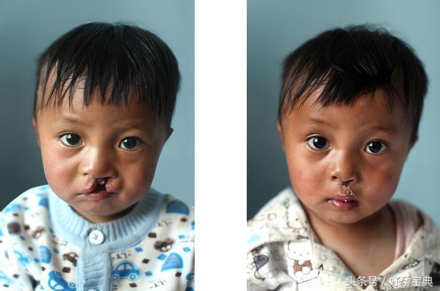 50元，儿童画挂历到手！唇腭裂儿童将会收到您的爱心……