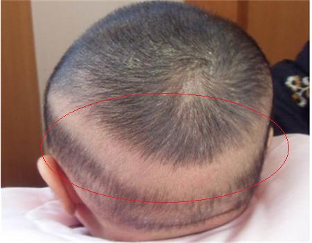 怎么查小月龄宝宝缺不缺维生素d,宝宝冬季怎么补充维生素