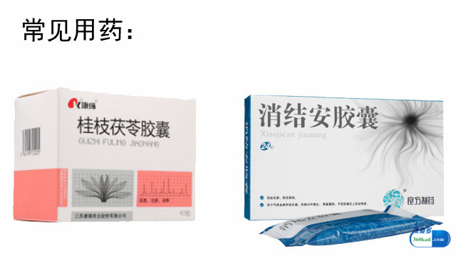 卵巢囊肿21mmx16mm有什么症状,切除卵巢囊肿后可以服什么药物