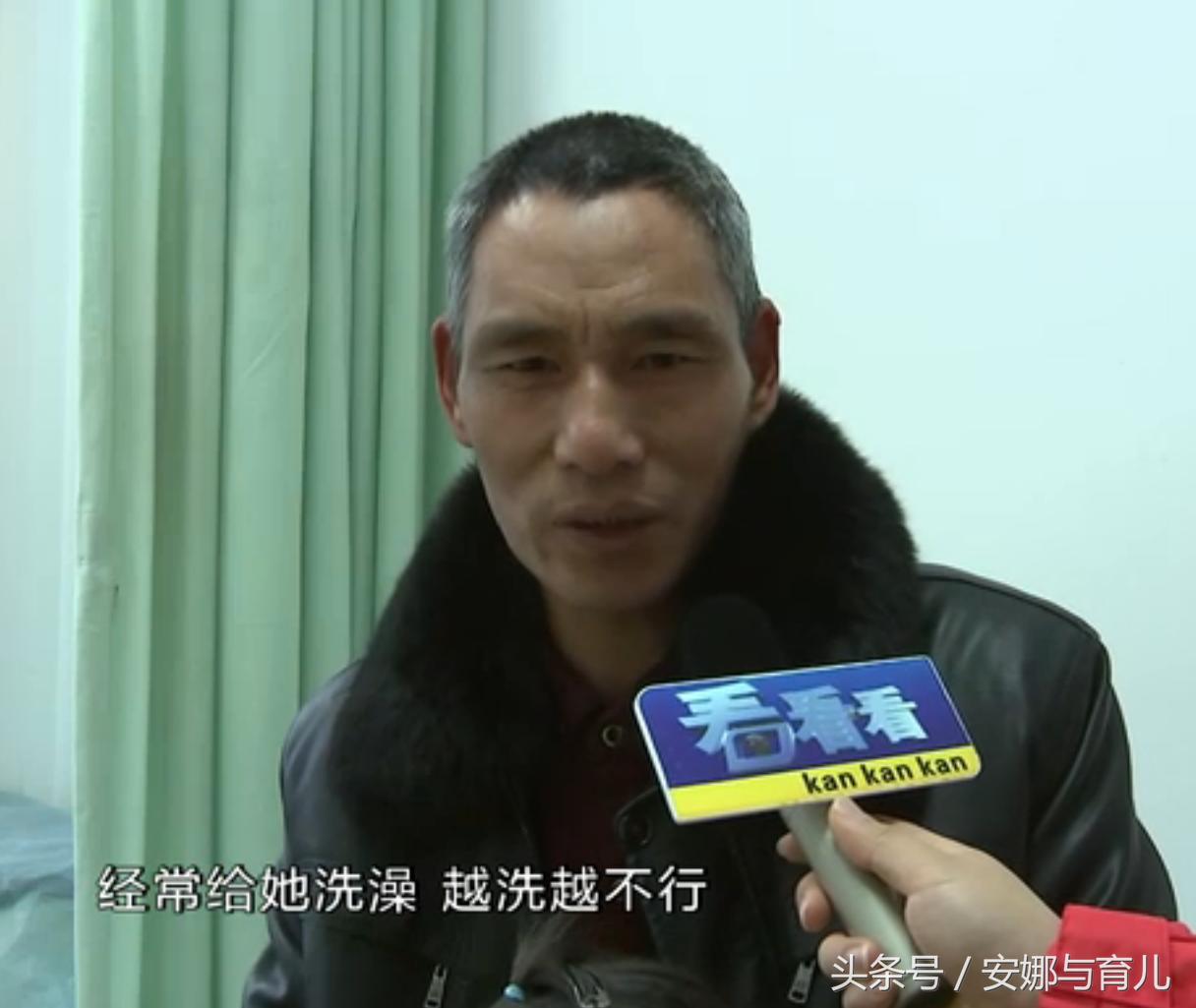 4岁女孩身上发痒,儿童身上奇痒无比怎么办