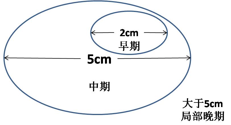 如何读懂乳腺癌病历单,怎么看懂乳腺癌的病理报告