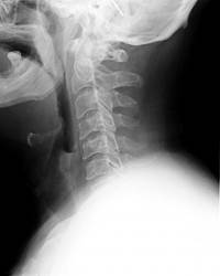 运动康复师教看核磁,运动康复脊骨梳理训练