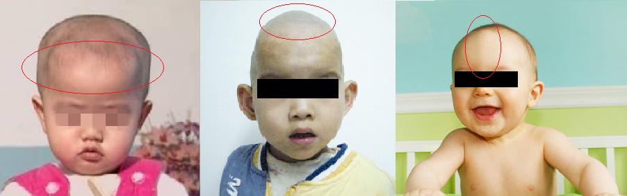 怎么查小月龄宝宝缺不缺维生素d,宝宝冬季怎么补充维生素