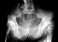 运动康复师教看核磁,运动康复脊骨梳理训练