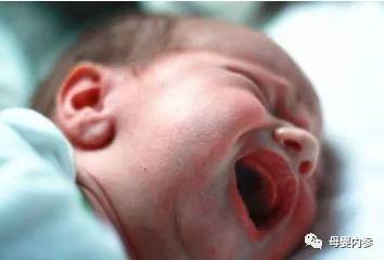 新生儿吃什么益生菌能缓解肠绞痛,婴儿肠绞痛症状和缓解办法