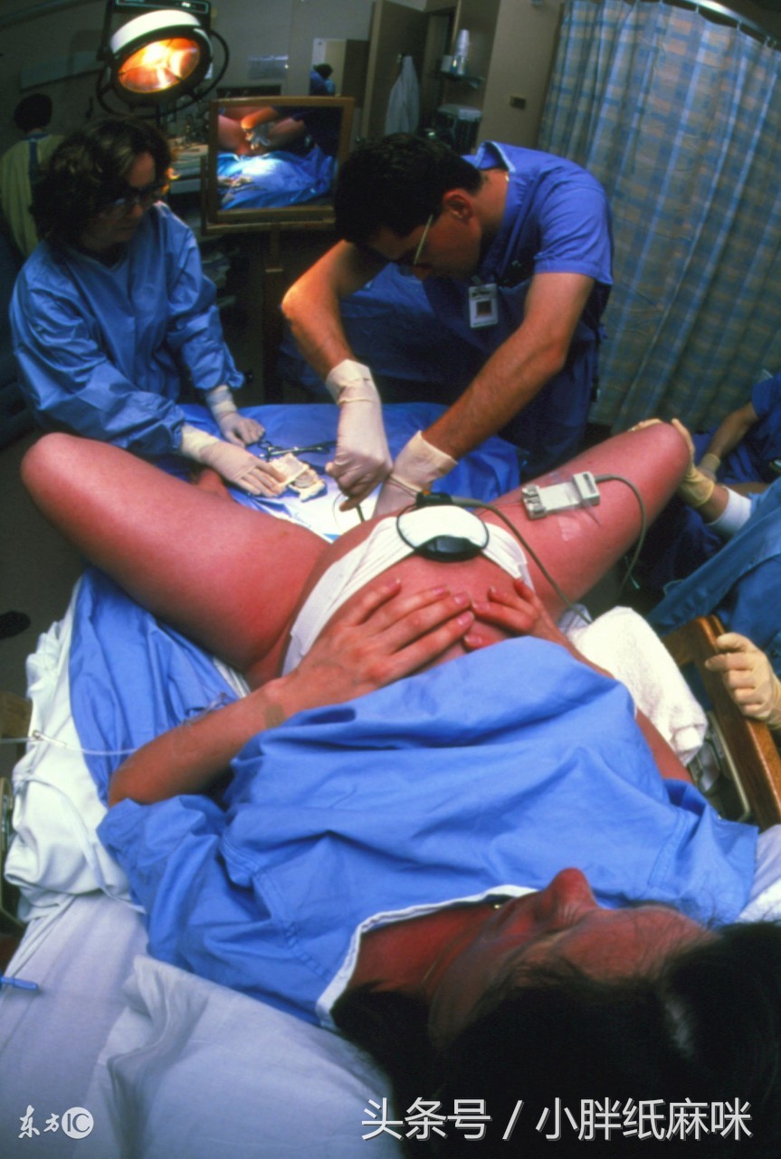 为什么很多顺产都侧切,顺产你得过哪些后遗症