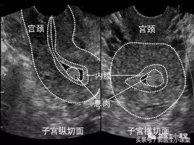 喝豆浆竟然会引起这个妇科病？