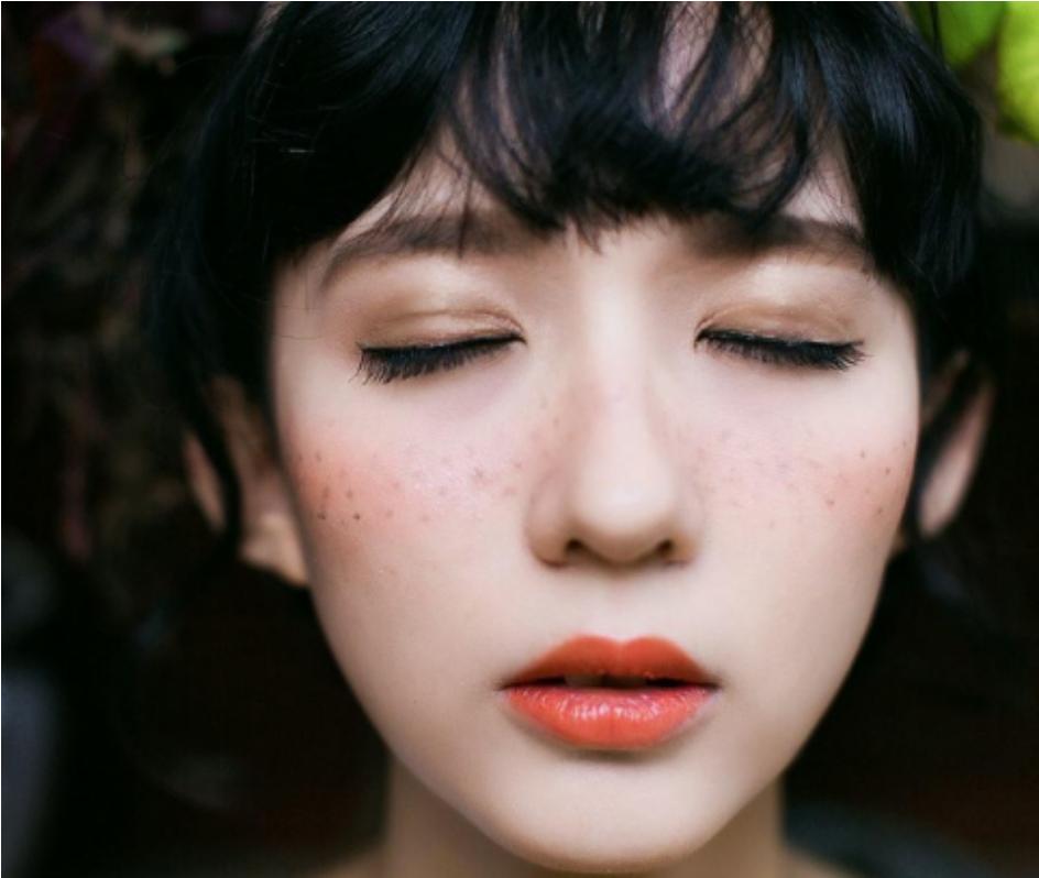 遗传性雀斑激光祛斑能彻底祛斑吗,雀斑祛斑最有效方法小妙招