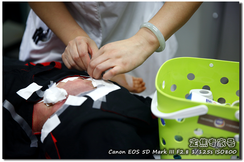 脸上大面积起红斑怎么回事,脸上红斑怎么消除最快